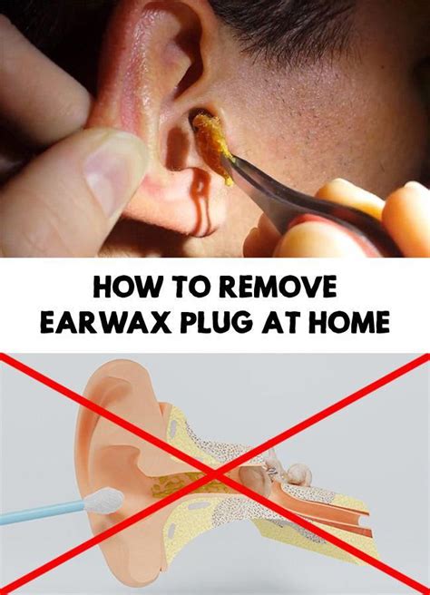 How To Remove Earwax Plug At Home Ear Wax Dry Skin Routine Hearing