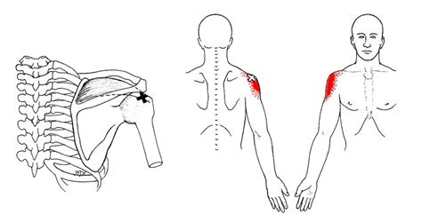 The Trigger Point And Referred Pain Guide 5