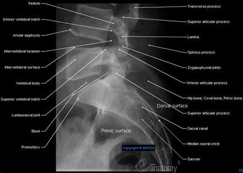 Radiological Anatomy Of The Spine Radiology Radiology Technologist