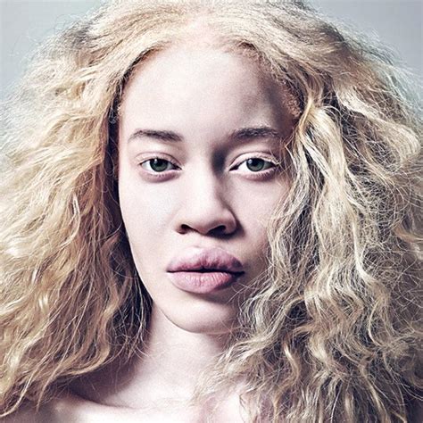 Güzellik Tabularını Yıkan Afro Amerikan Albino Model Diandra Forrest