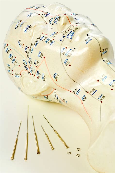 Acupuncture And Everything You Need To Know About It