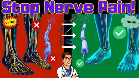 Peripheral Neuropathy Treatment Leg And Foot Nerve Pain Home Remedies