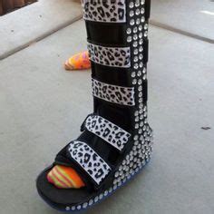 full leg cast | Fabulous Leg Casts | Pinterest | Leg cast ...