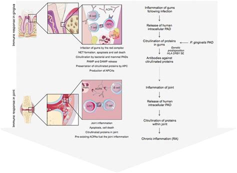 A Model Of Periodontitis Initiated Pathogenesis Of Rheumatoid Arthritis