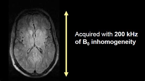 Are Mris Oriented Magnetic Field Dr Bakst Magnetics