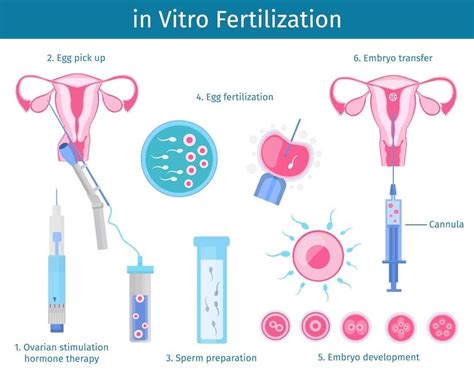 In Vitro Fertilization Ivf Explained By Yaamifertilityandivf Sep
