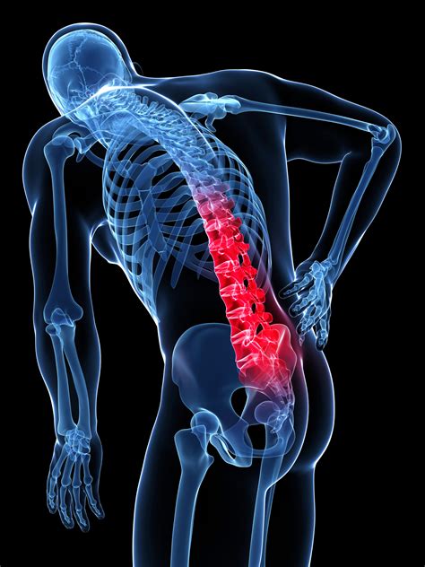 What Are The Risk Factors For Back Pain? Must Know!!!