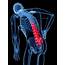 What Are The Risk Factors For Back Pain Must Know