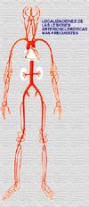 Causas de solfa syllable trombosis through. SECCION DEL PACIENTE