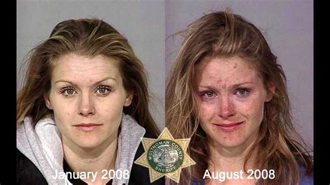 Drugs Abuse Faces Before And After Addicted Condition Wechc