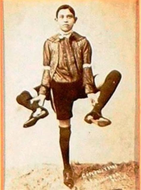 Who Was Frank Lentini The Three Legged Football Player With 2 Penises