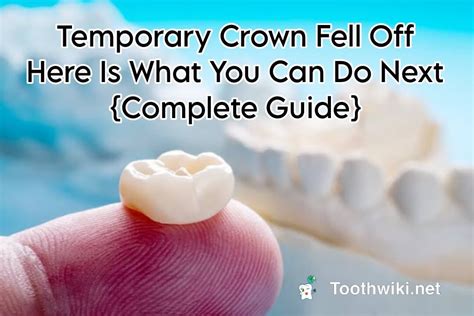 Your Temporary Crown Fell Off Heres What To Do Toothwiki