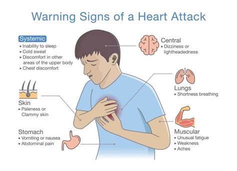 What Are Mens Symptoms Of A Heart Attack Warning Signs In Men