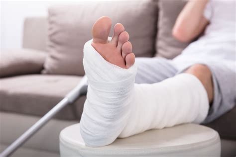 Ankle sprains are common injuries that occur among symptoms of a severe sprain are similar to those of a broken bone and require prompt medical evaluation. 5 Signs of a Fracture vs. a Broken Bone | Zuber Brioux