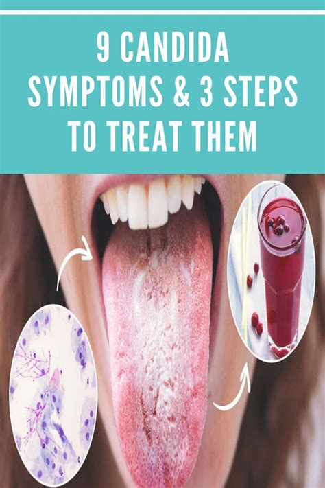 9 Candida Symptoms And 3 Steps To Treat Them Healthy Drinks Smoothies