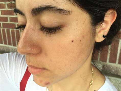 21 Things People With Oily Skin Are Sick Of Hearing