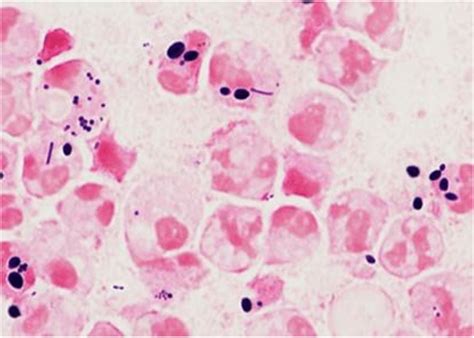 Mycoplasma Pneumoniae Gram Stain