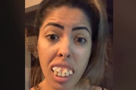Woman Trolls The Internet With Her Teeth Transformation You