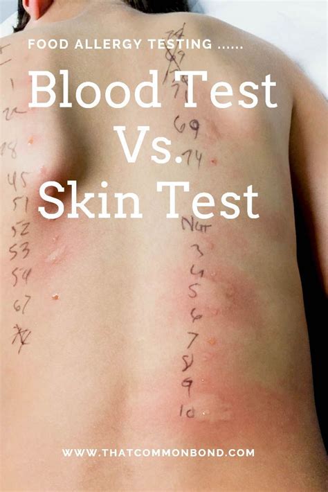 There is a lack of research on this type of analysis and its accuracy cannot be. Pin on Skin problems