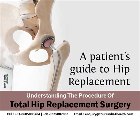 Advanced Hip Replacement Surgery In India At Low Cost Hip Replacement