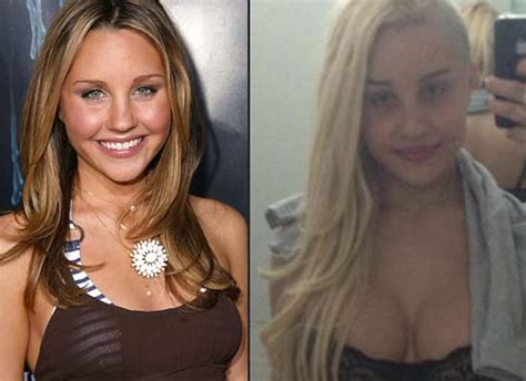 Amanda Bynes Plastic Surgery Photo Before And After CELEB SURGERY COM