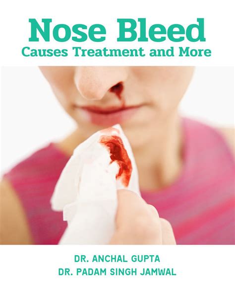 Nose Bleed Causes Ubicaciondepersonascdmxgobmx