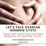 Do Ovarian Cysts Cause Gas Images