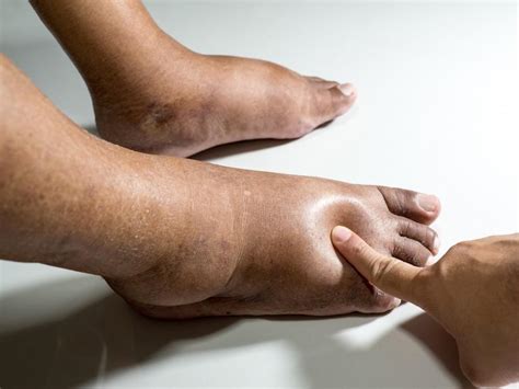 5 Helpful Tips To Care For Your Diabetic Foot At Home Chicagoland Foot