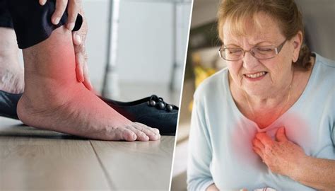 5 Scary Symptoms Related To Swollen Feet 5 Can Lead To Heart Failure