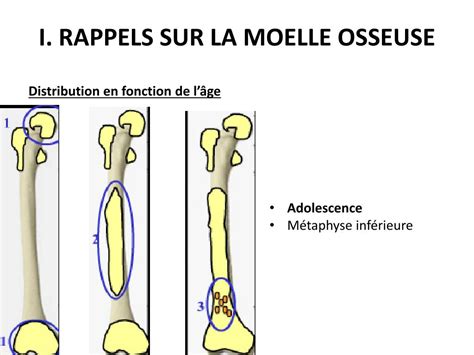 Ppt Irm De La Moelle Osseuse Aspect Normal Variantes Et Pathologie
