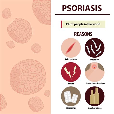 Home Remedies And Ayurvedic Treatment For Psoriasis Sidhmam