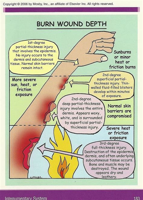 Burn Wound Depth Infographic Nursingstudents Nurseeducator