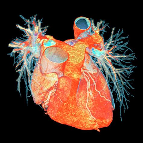 Human Heart Photograph By K H Fungscience Photo Library Pixels