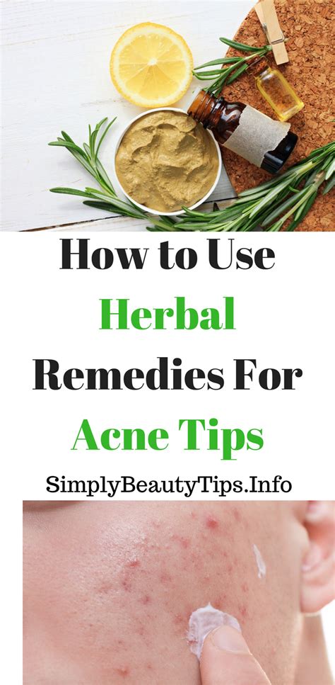 How To Use Herbal Remedies For Acne Tips Simplybeautytipsinfo Acne
