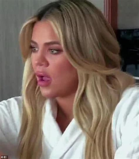 Khloe Kardashian Insists Her Lips Look Big Because She Overlines