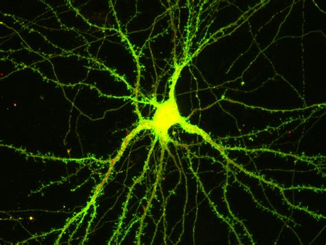Wichtig Fürs Lernen Protein Stärkt Kontaktstellen Von Nervenzellen