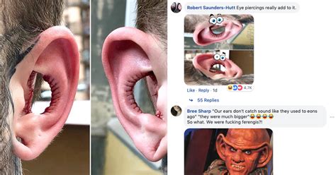 Guy Removes Inside Of Ears In Bizarre Body Modification Gets Ear Reversibly Roasted By The Internet
