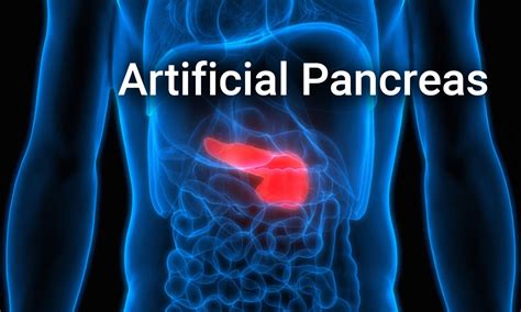 For The First Time Researchers Trial Artificial Pancreas On