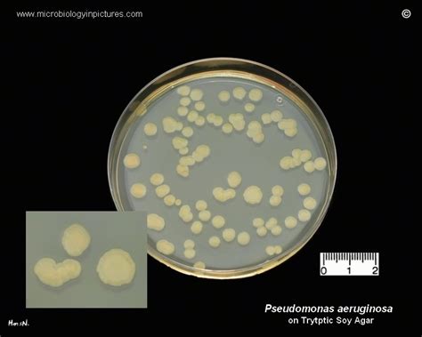 Pseudomonas Aeruginosa Pure Culture In Petri Dish With Tryptic Soy Agar