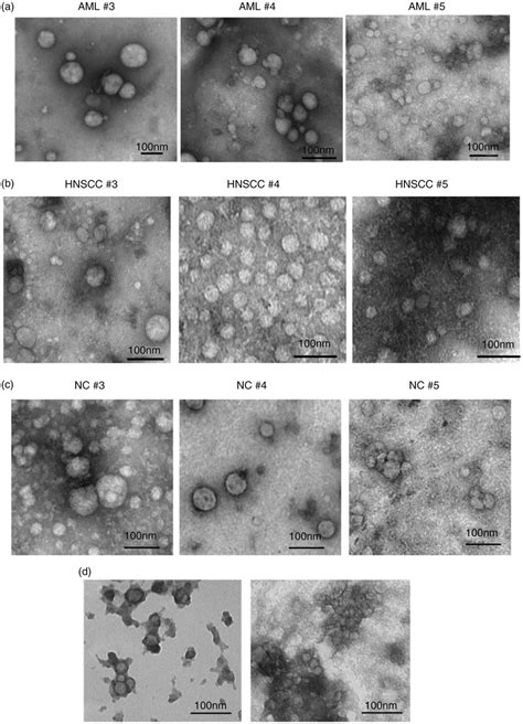 Transmission Electron Microscopy Tem Of Vesicles Eluted In Mini Sec