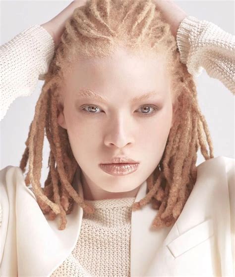 Damaris Albino African Modelo Albino Albino Model Albino Girl Pretty People Beautiful