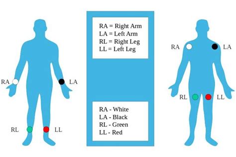 Limb Electrodes Ecg Lead Placement 12 Lead Placement