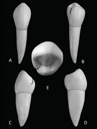 The Permanent Maxillary And Mandibular Premolar Teeth Intechopen