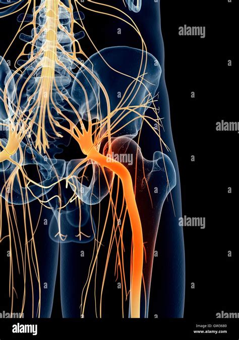 Human Sciatic Nerve Pain Illustration Stock Photo Alamy