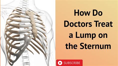 How Do Doctors Treat A Lump On The Sternum Youtube