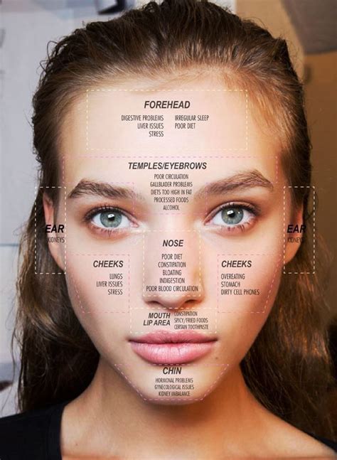 Face Mapping What Your Acne Is Telling You Homemade Acne Treatment