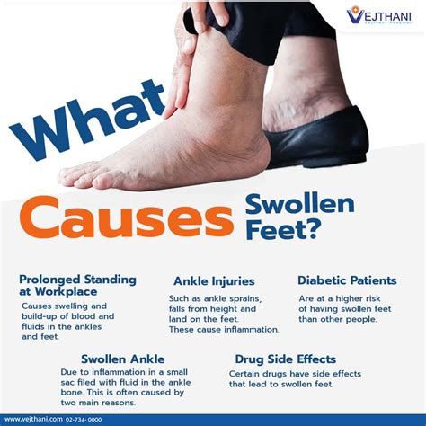 What Causes Swollen Feet Vejthani Hospital Jci Accredited