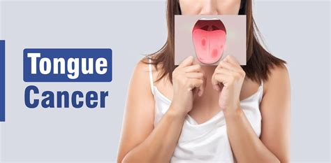 Tongue Cancer Causes Symptoms Diagnosis And Treatment Dr Priya Tiwari