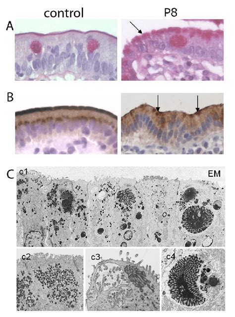 Immunohistochemical And Ultrastructural Characteristics Of Mid