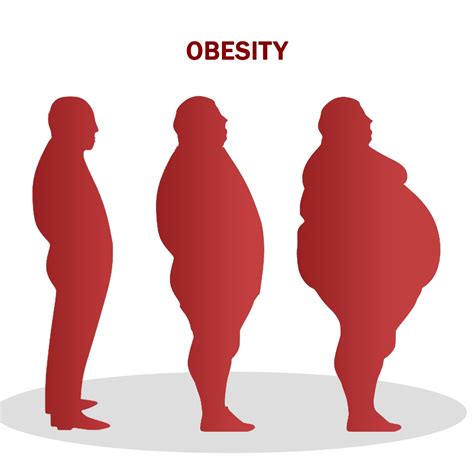 Obesity Treatmentbest Surgery Hospitals Specialist Doctors In Coimbatore